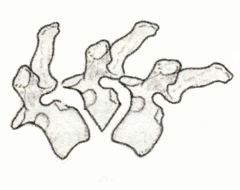 Hemivertebrae & Vertebral Malformation Melbourne Bulldog Clinic